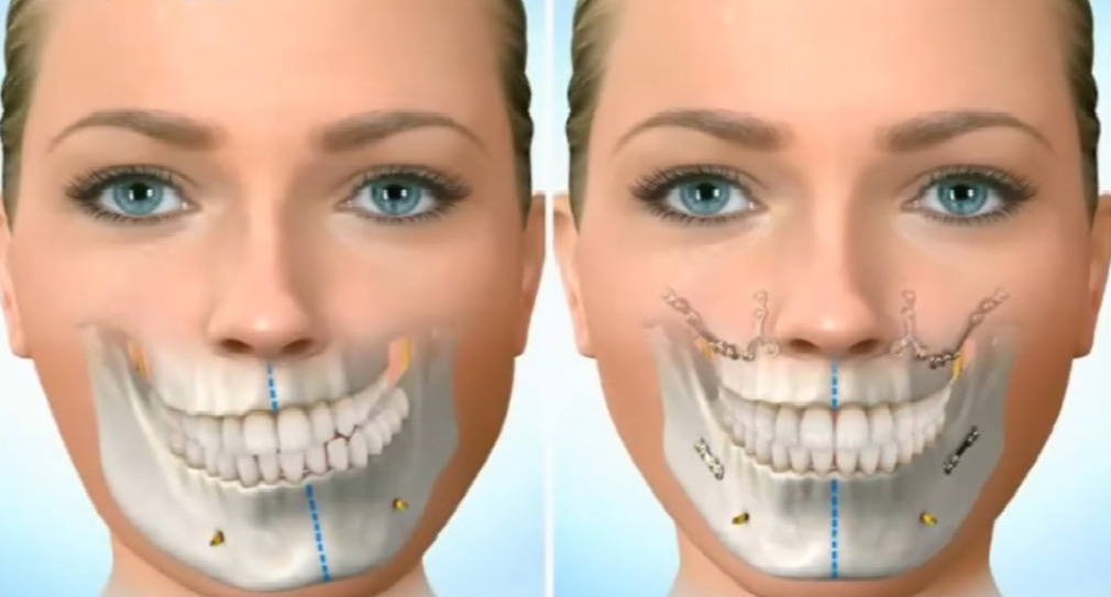 DHB Odontologia