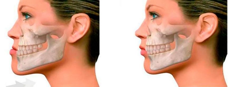 DHB Odontologia