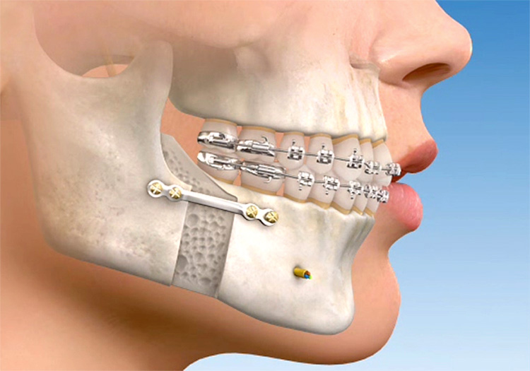 DHB Odontologia