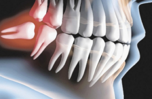 DHB Odontologia