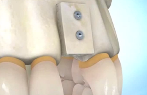 DHB Odontologia
